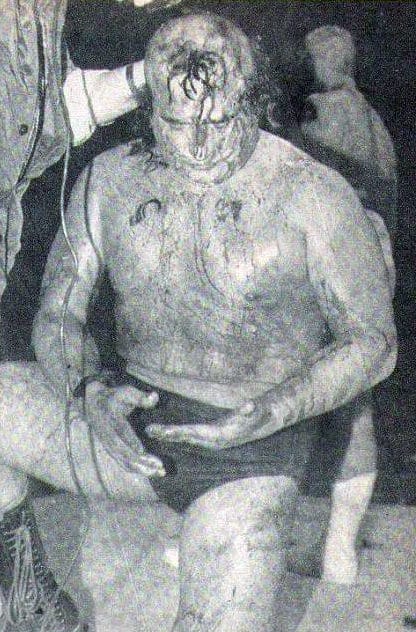 En un día como hoy... Satánico y Sangre Chicana empatan en lucha de cabelleras 5 Adorable Rubí sin su cabellera (10 de diciembre de 1982).