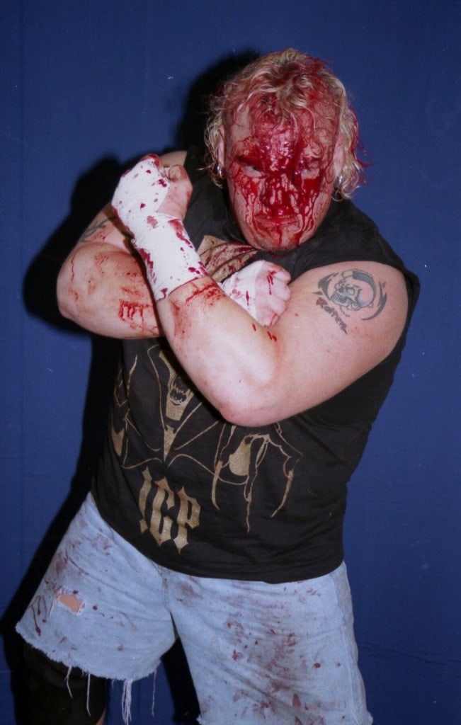 Axl Rotten