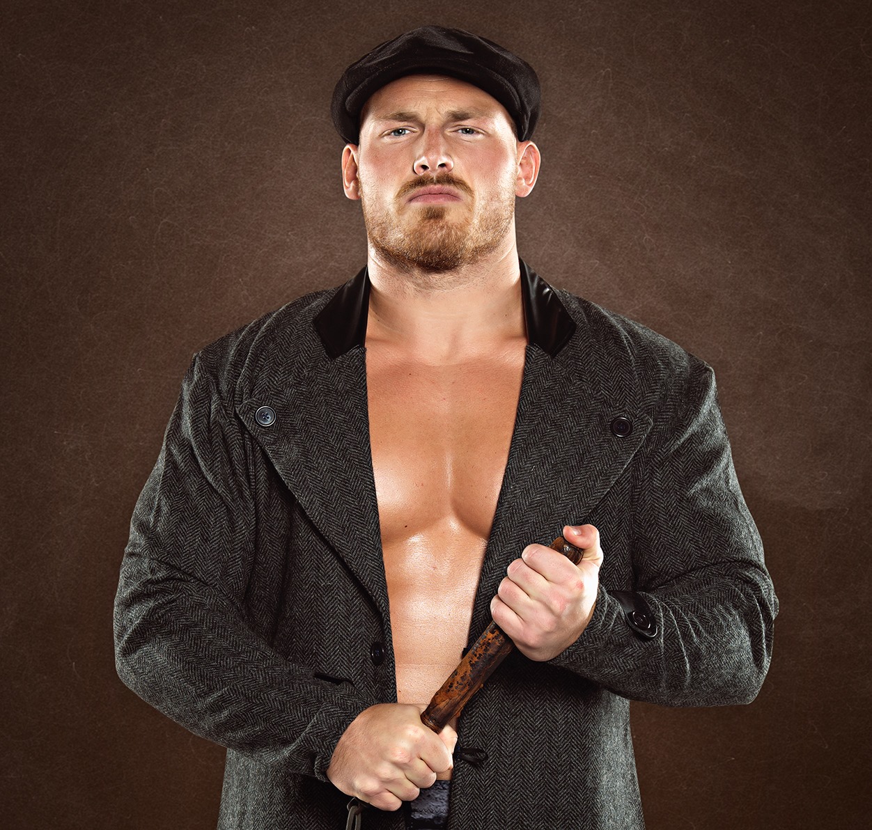 Ridge Holland revela cómo fue la cirugía tras romperse la nariz