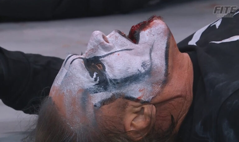 Sting