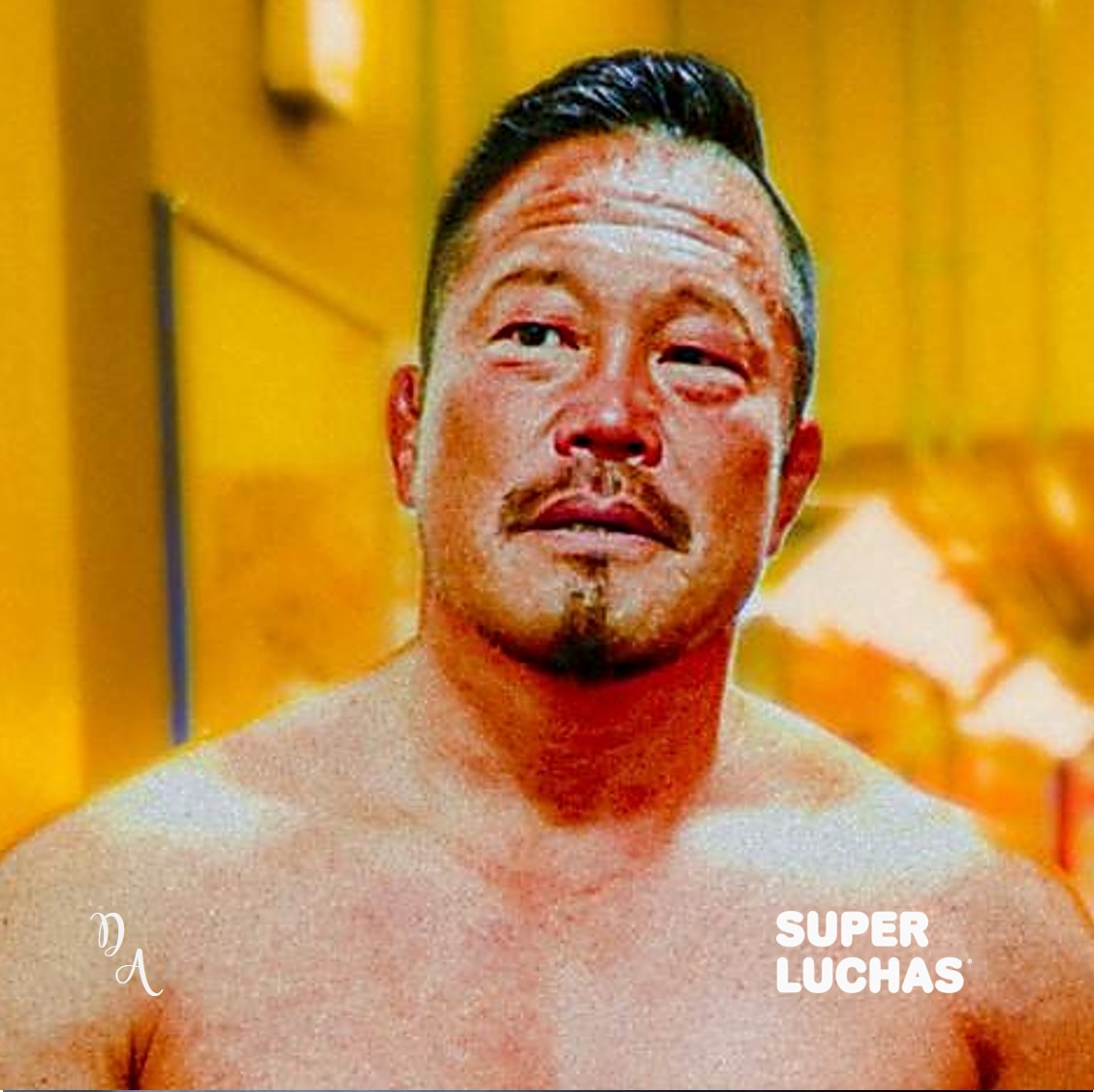 NOAH La cirugía ocular de Takashi Sugiura Superluchas