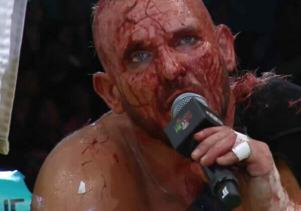 Un luchador de lucha estelar en Triplemanía sostiene un micrófono con sangre en la cara.