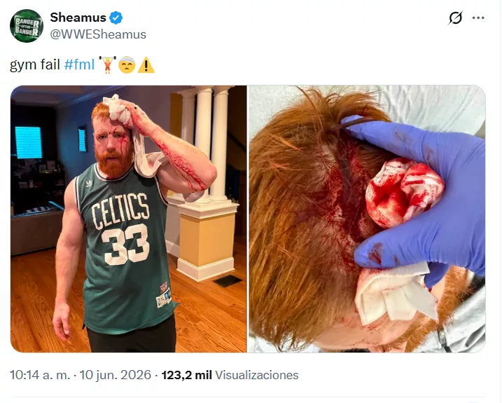 Sheamus